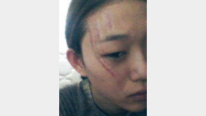 [스타 온라인] ‘도수코3’ 최소라, 안티팬에 기습 테러