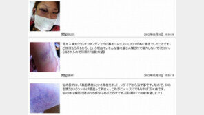 日 여가수 “이 와인병으로 폭행” 사진 공개