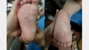 바늘학대 동영상 충격, 피해아동 바늘만 봐도 ‘벌벌’