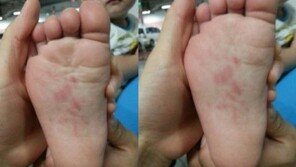 발 만지며 “아야”…어린이집 또 ‘바늘학대’? 경찰 “사실관계 확인중”