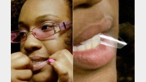 셀로판 테이프 중독女 화제, 한 달에 1.8km ‘꿀꺽’