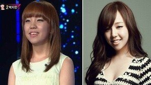 백아연, 라미네이트 시술 전후 비교하니 ‘거의 성형 수준?’ 