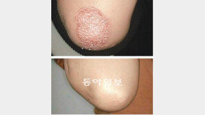 [헬스&뷰티]고운누리한의원 ‘한열조습조화론’ 치료