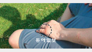 [호주의 한인들이 떨고 있다]<上> 그날 멜버른에선 무슨 일이… 손가락 잘린 한인 청년