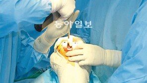 [헬스&뷰티]비급여 진료 줄이니 인공관절 수술 반값으로 가능하네