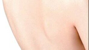 [헬스&뷰티]울긋불긋 등 여드름… 피지 관리로 뒤태 미녀 되자