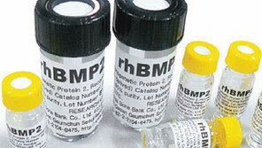 [헬스&뷰티]관절 고치는 ‘골형성단백질’ 국내 최초 개발