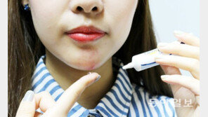 [헬스&뷰티]오래된 흉터로 남모를 고민? 흉터 연고 바르세요