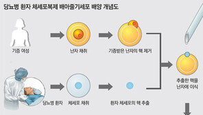 “환자 맞춤 줄기세포 치료제 청신호”