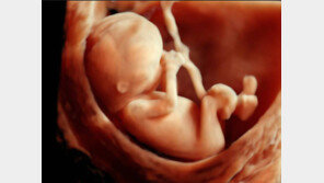 [헬스&뷰티]의료기기도 3D 바람… 선명한 화질로 진단 정확해져