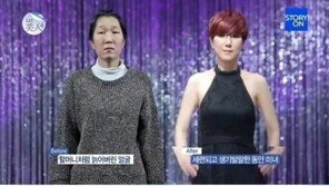 ‘렛미인’ 20대女, ‘할머니처럼 늙어버린 외모’… 치아도 거의 없어