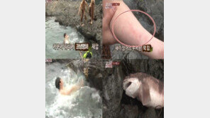 시간탐험대 유상무, 상어에 팔 물려 상처… “위험천만했네!”