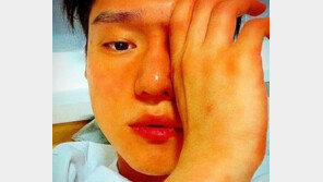 고경표 ‘뇌수막염’ 입원, 퉁퉁 부은 얼굴…“심각하네”