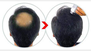 [스마트 컨슈머/헬스&창업]탈모 고민? ‘슈퍼밀리언헤어’로 감쪽같이