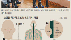 하반신 마비 男, 코 신경세포 이식뒤 뚜벅뚜벅