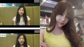 모태미인 천이슬, 사실은 성형외과 협찬 받았다?