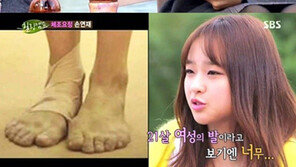 ‘힐링캠프’ 손연재, “훈련으로 발 모양 변형...성한 곳이 없다”  
