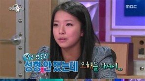 라디오스타 송가연, 성형의혹에 “코뼈 부러져 할 수 없었다”