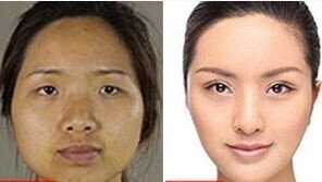 “달라도 너무 달라” 한국서 성형 中여성들, 공항에서 ‘봉변’