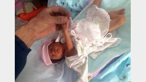 ‘사산아인 줄 알았는데…’ 2시간 동안 땅에 묻혔다 살아나온 아기