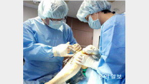 추운날 뼛속까지 시린 통증… 퇴행성관절염, 3040 여성환자도 늘어 