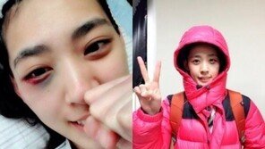 ‘미녀파이터’ 박지혜, 피멍에도 빛나는 미모… ‘남편, 김지형 선수’