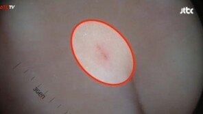 어린이집 40대 여교사, 바늘 학대… 이유 알고보니 “준비물 안 가져와서”