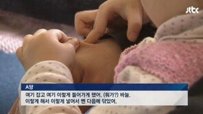 어린이집 바늘 학대, 피해 아이 본 의사 “다발성 상처로 보인다”