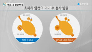 초파리로 밝혀낸 불임의 원인 “결국 문제는 스트레스”