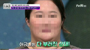 치통환자 증가, 무려 80만 5000명