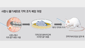 손상된 각막, 사랑니 줄기세포로 치료 길 열려