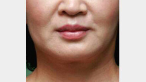 얼굴 커지는 습관, 딱딱한 음식 · 이를 악무는 습관도 얼굴 커질 수 있어?