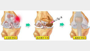 제일정형외과병원, 신생아 태반에서 추출한 줄기세포 배양