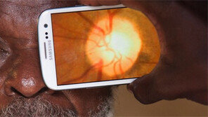 스마트폰으로 백내장-심장병 진단 ‘끝’