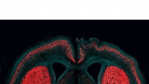 인간이 유인원보다 머리 좋아진 비결 찾았다… 바로 ‘○○○ 유전자’
