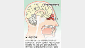 강박장애 진단법, 반복적인 행동이 강박으로 이어져…“혹시 나도?” 깜짝