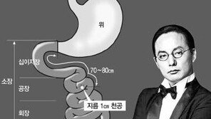 신해철 사망은 의료과실, 사진 상으로 복막염 증세 진행되고 있었음에도...