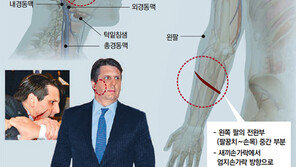 상처 1cm 더 길었으면 경동맥 치명상… 왼팔은 칼 막다 관통