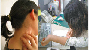 20대女 ‘편평사마귀’ 유행에 주의보…얼굴-팔뚝 곳곳에 물집 ‘스트레스 만땅’ 