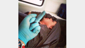 20대 女구급대원, 응급 환자에 ‘손가락 욕’ 셀카 논란