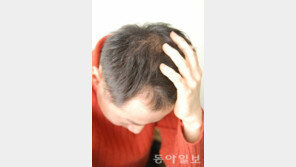 환절기 탈모 예방법 공개… 탈모 유전자 자극하는 음식 섭취 자제