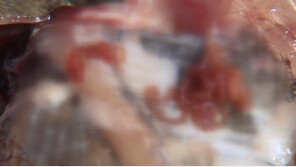 끔찍한 ‘고래회충’, 약물 치료법 없고 수술로 떼어 내야…