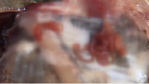 울산 앞바다 정체 불명 ‘고래회충’ 발견…위벽 뚫고 ‘복통·구토 유발’