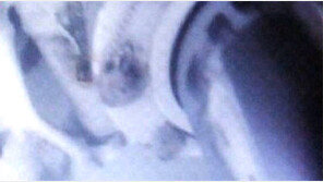 수색 6일만에… 가거도 추락헬기 동체 발견