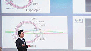 아이리움안과, 근거리 작업 어려운 40∼50대, 노안교정술 바람 