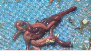 한강 하류에 ‘끈벌레’ 집단 출몰…어민들 조업 중단