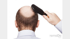 [라메드] 대머리 김과장은 정력왕? 탈모에 관한 속설과 진실