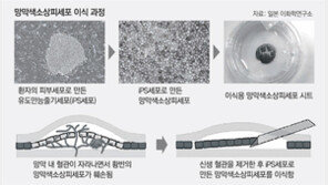 日정부, ‘iPS세포 치료제 상용화 기술’ 법안 만들어 전폭지원