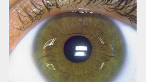 눈으로 보는 건강신호, 각막 주변에 하얀색 테두리가 있다면…