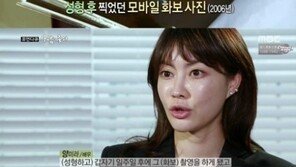 ‘사람이 좋다’ 양미라, “성형 7일 후 화보 촬영…그렇게 거북하게 나올지 몰랐다”